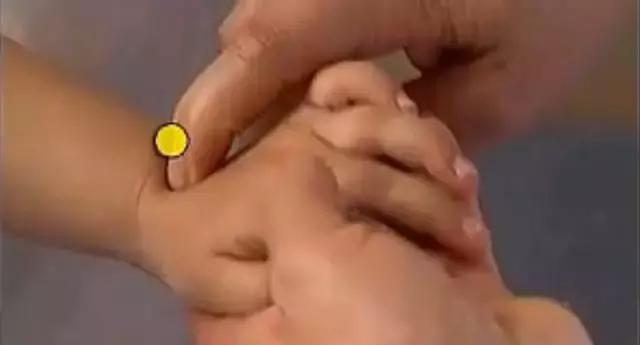 孩子湿疹怕用药有激素,不妨试试这几个穴位