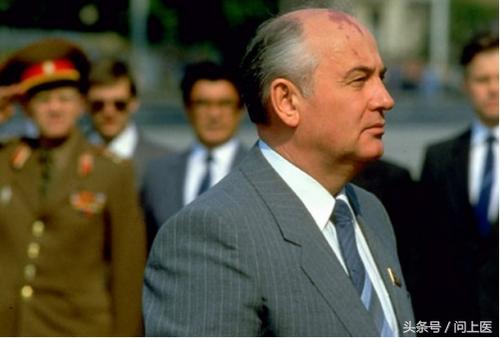 你有胎记吗？图解8种常见胎记