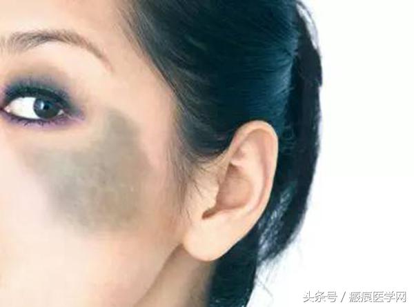 这么多年，还在和太田痣纠缠不清！