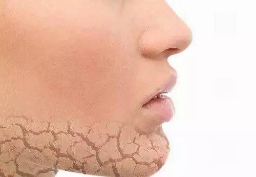 正确护肤最关键的一步要分清肤质,护肤第一步快速了解自己的肤质