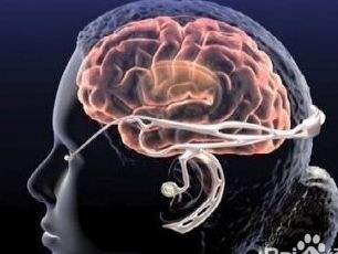 垂体瘤手术恢复正常来月经吗,垂体瘤手术两个月还是不来例假