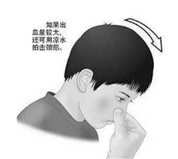 一招解决生活小妙招,治疗生活中的小毛病的小妙招