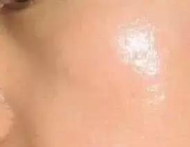 护肤品含香精对皮肤有什么危害,护肤品含汞对人体的危害