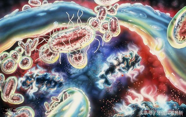 牙齿为什么和牙肉分离,牙床与牙齿分离是什么原因