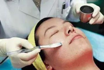 12岁孩子脸上黑头粉刺如何处理,男士脸上黑头粉刺怎么去除