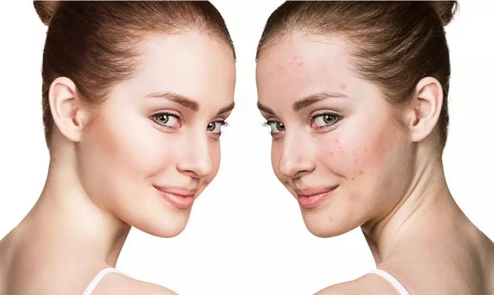 正确护肤最关键的一步要分清肤质,护肤第一步快速了解自己的肤质