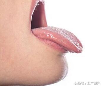 千寒易除一湿难去怎么解释,千寒易除一湿难去湿气属于什么