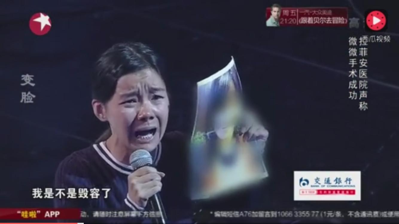 韩国整形手术有多可怕,韩国整形最难做的手术