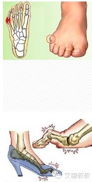 怎么有效教孩子区分左右鞋,对于穿错鞋子的孩子教育措施