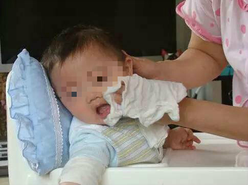 孩子身上长了大黑痣怎么办,孩子脸上长了黑痣家长特别焦虑