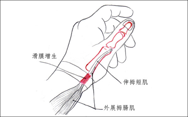 新手妈妈养孩子的危害,新手妈妈养娃痛点