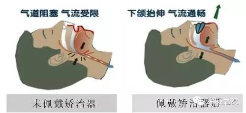 害怕睡着后再也醒不来,很难入睡但是睡着了又醒不来