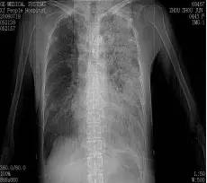 急诊科的困难,急诊科医生吃东西呕吐
