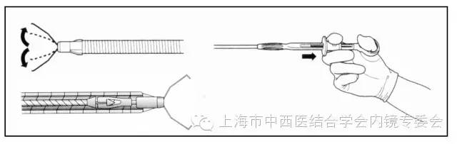 消化内镜仪器操作,消化内镜护理操作名称
