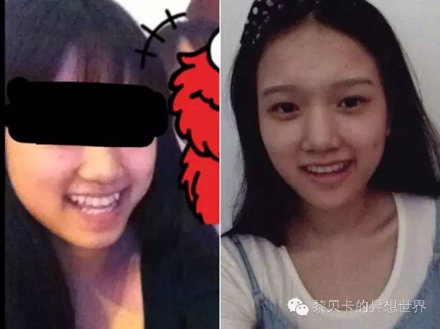 她们说||那些年整牙吞下的血和泪,终于换来最开怀的大笑