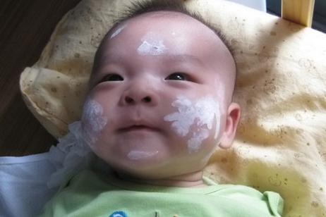 老月嫂的100个小妙招,育婴师如何解决宝宝湿疹问题