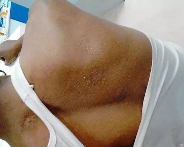 呼气中有烂苹果味是什么病,口中有苹果味是什么原因