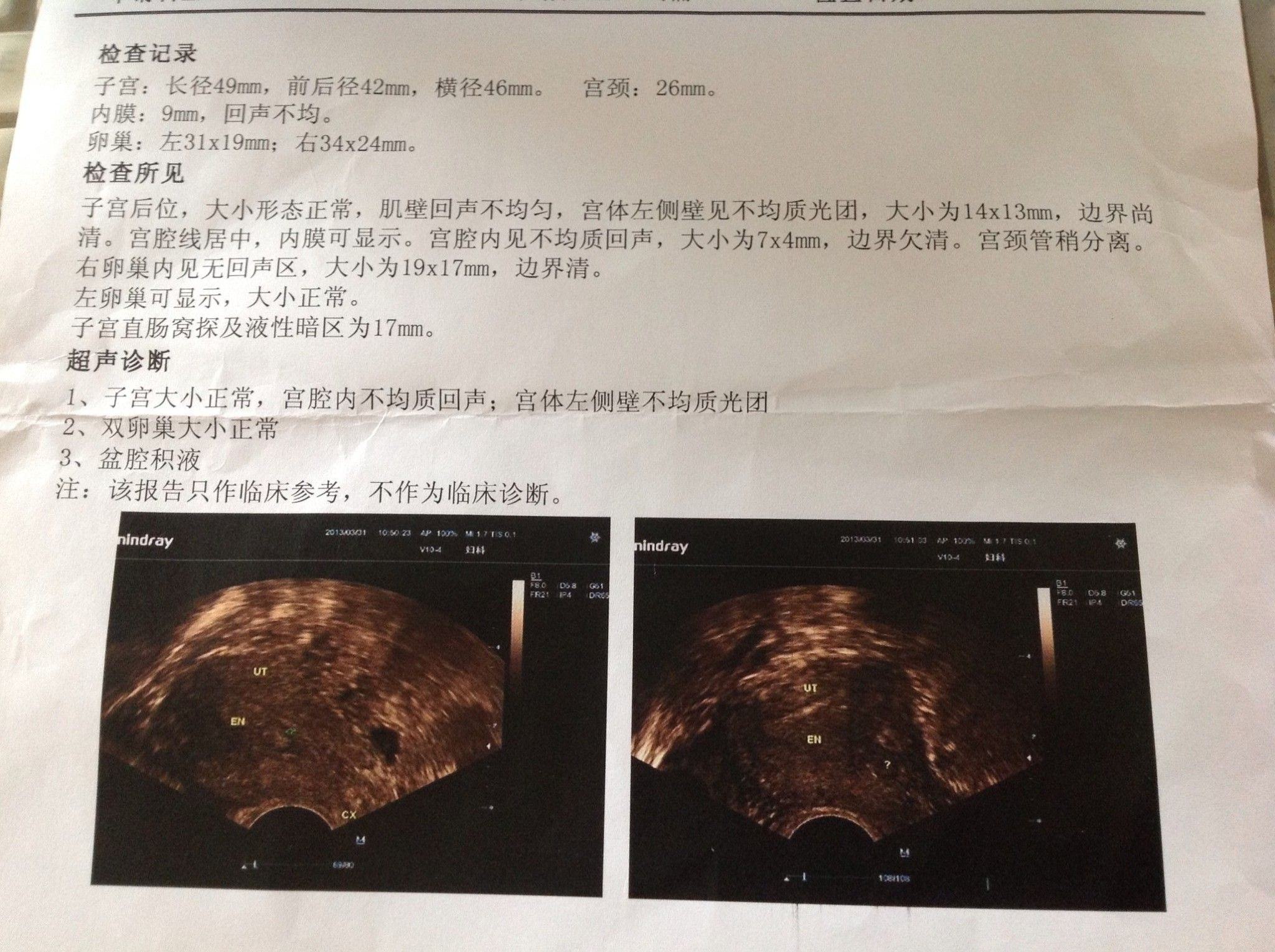 教你如何轻松看懂b超单,怎么看懂b超图和实际图