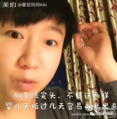婴儿湿疹头垢洗了之后一直在出水,新生儿头垢和湿疹结痂的区别