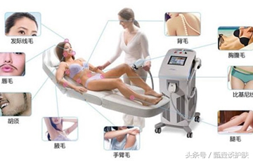 唇部脱毛哪种方式最好,脱毛哪种方法效果比较好呢