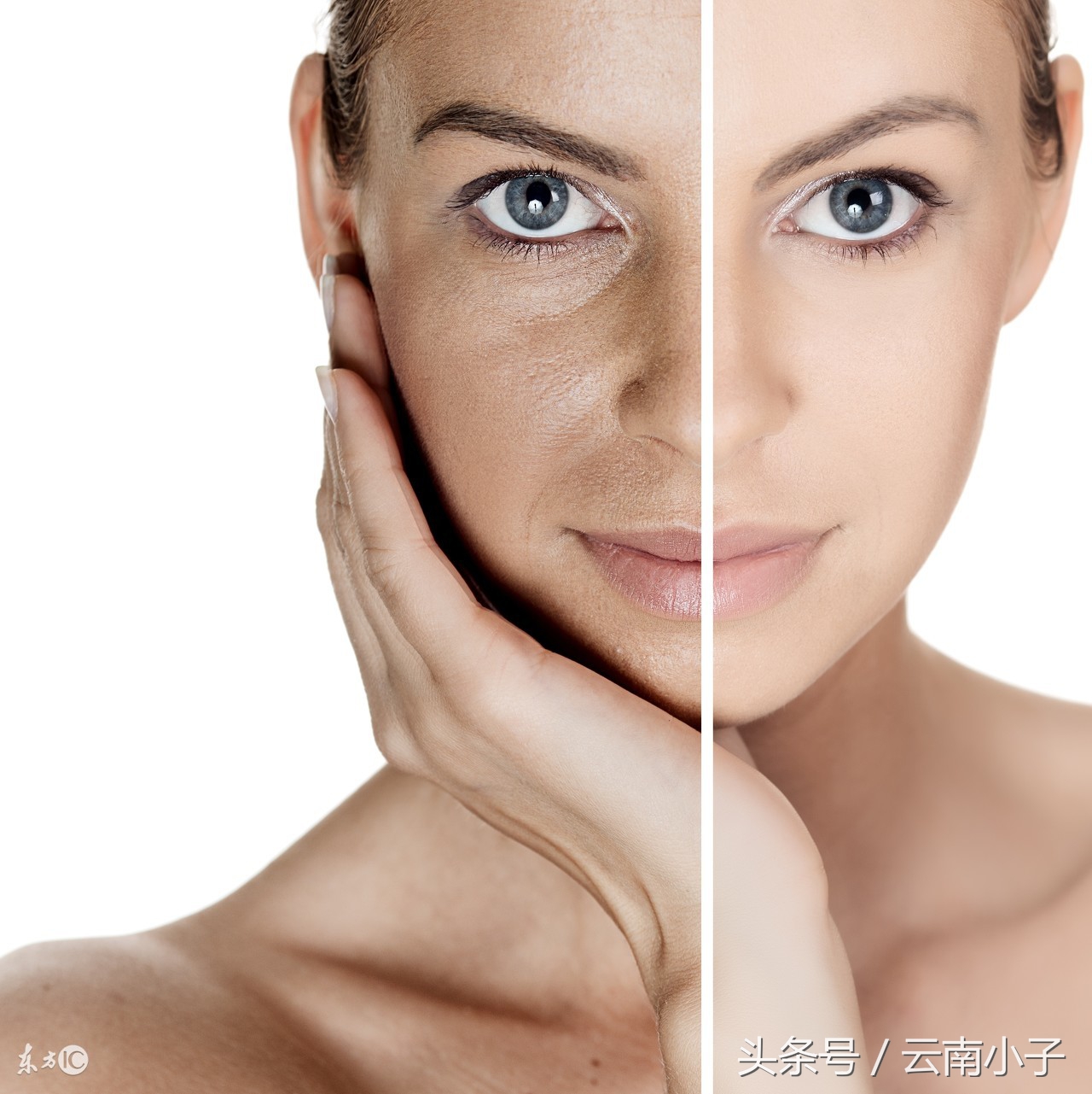 我吃三七粉，主要降低三高，怎么脸上的雀斑全没了！