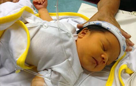 新生儿黄疸正常值表,新生儿黄疸如何避免