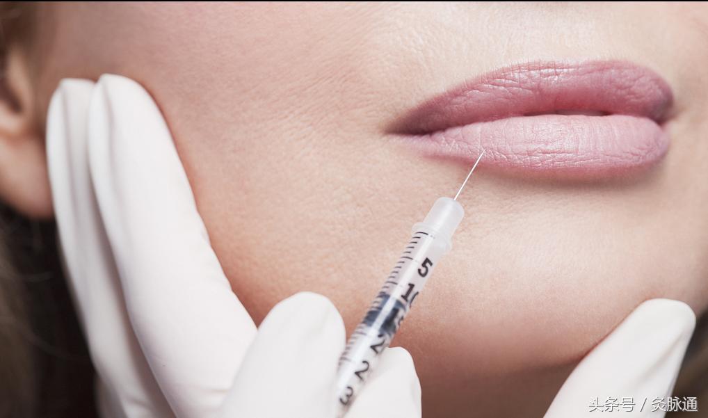 拒绝玻尿酸，女人坚持艾灸一穴就能青春永驻