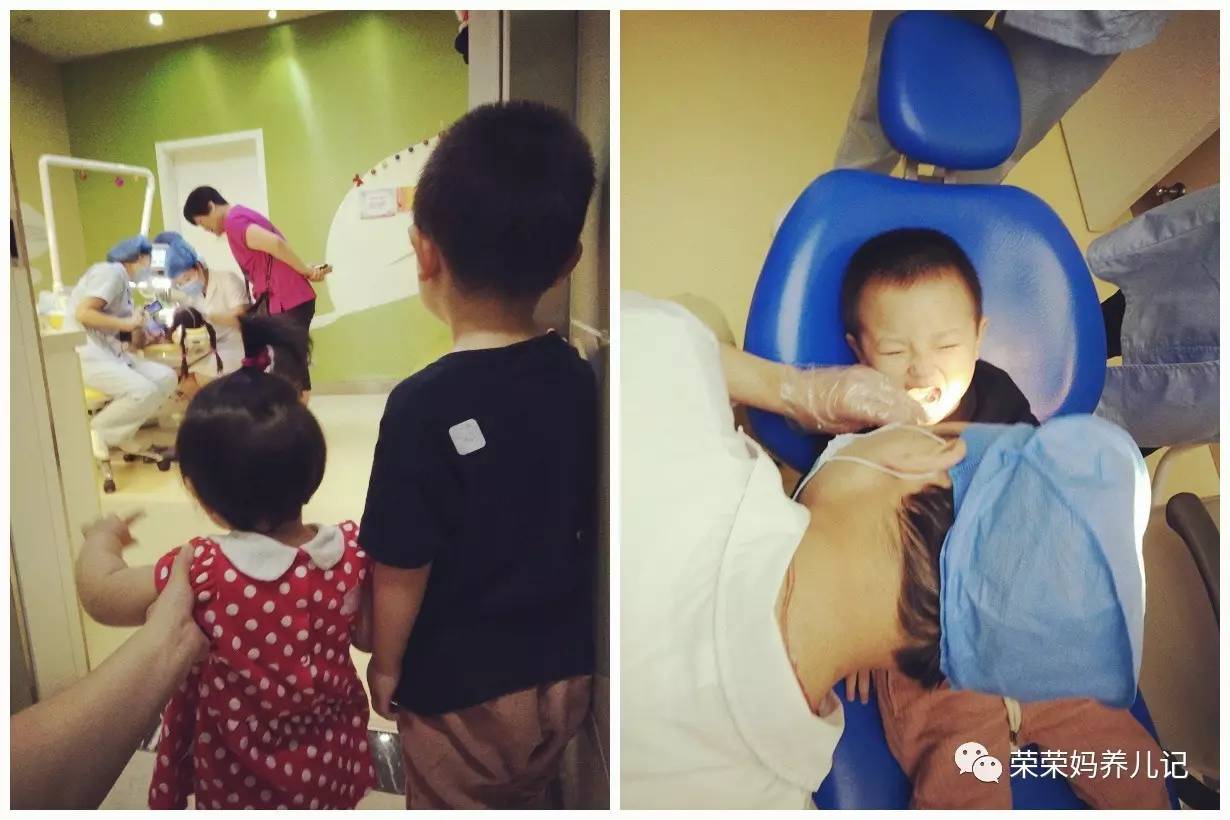 儿童涂氟前需要做口腔内窥镜吗,小孩牙齿涂氟好还是做窝沟封闭好