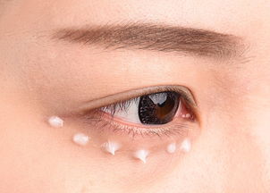 眼袋的形成原因及处理办法,眼袋的形成原因和治疗方法