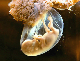 孕晚期羊水少多喝水有用吗,孕期很注意饮食跟运动还是长肉