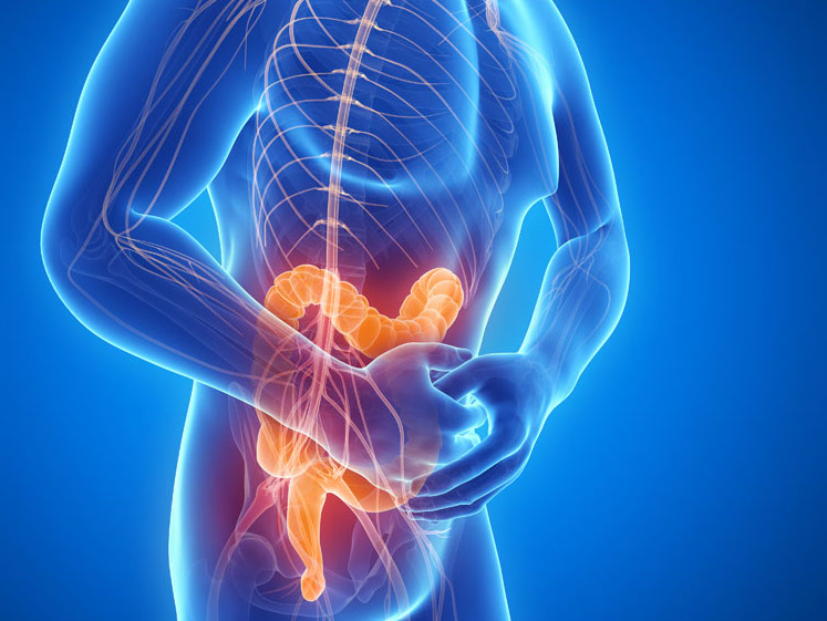 预防结肠癌最简单的方法,预防结肠癌的8种方式