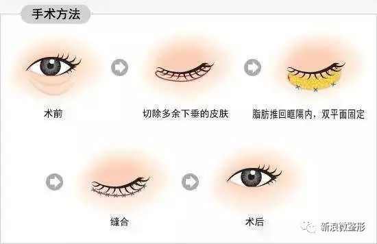 林小宅显老,林小宅算是翻车了吗