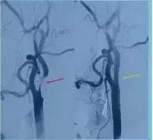 健康——它竟然能为病人拆除颅内不定时*弹炸**？它就是……