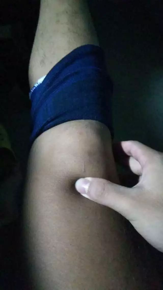 网球肘的最佳打法,三招搞定网球肘