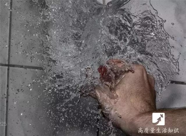 大人被开水烫伤怎么处理好得快,开水烫伤急救知识