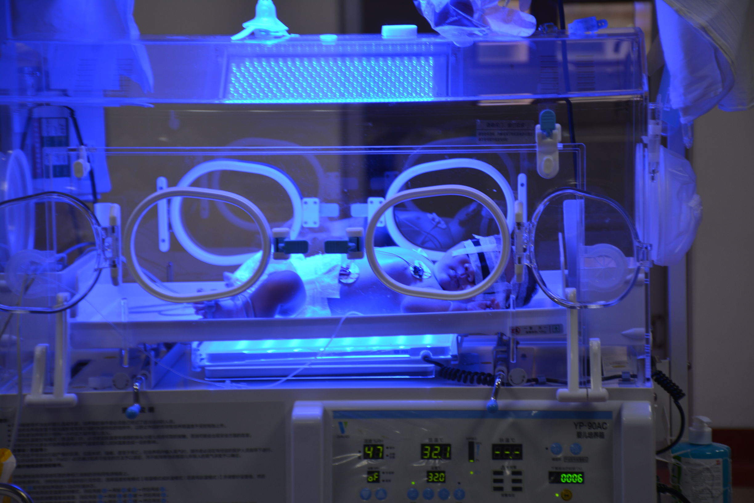 nicu新生儿重症监护室实拍,新乡nicu新生儿重症监护室