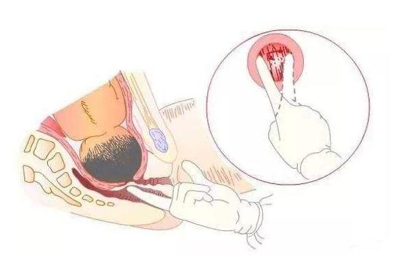 宫开五指什么意思,宫开是指开十指么