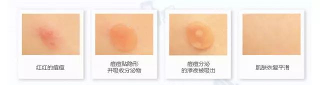 推荐屈臣氏好用又实惠的东西,屈臣氏值得买的平价好物