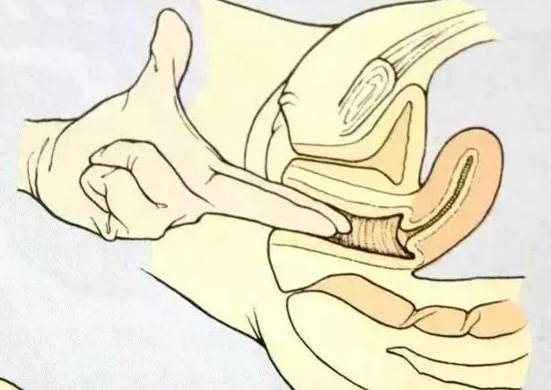 宫开五指什么意思,宫开是指开十指么
