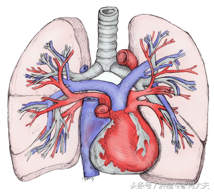 肺癌晚期临死30天症状,肺癌小细胞晚期快死的征兆