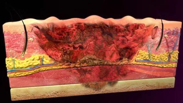 惊恐15秒！火锅热汤洒向小孩后，大人应该怎么办？