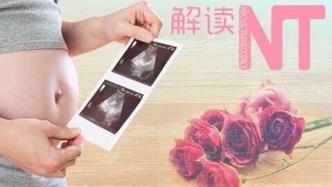 胎儿nt检查有必要吗,nt检查有必要吗