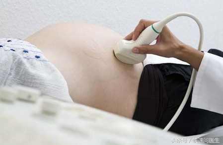 孕期超声能查出胎儿的异常,孕期怎么查看b超结果