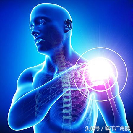 强力治疗肩周炎的特效药,治肩周炎一针见效