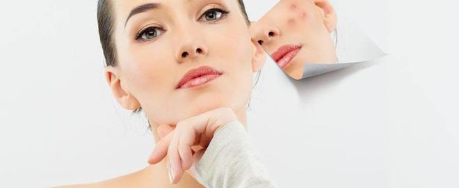 刷酸多久闭口才会彻底消失,刷酸爆闭口要不要继续刷