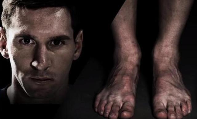 看脚就知道他们为什么是球坛巨星,詹姆斯完全变形,C罗脚趾发肿