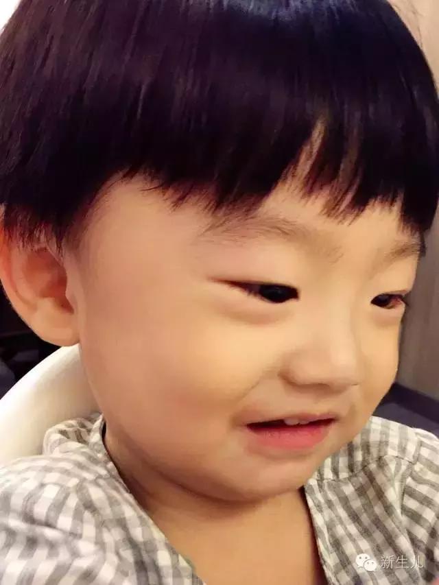 新生儿宝宝红疹子怎么引起的,新生儿皮肤起红疹子怎么办