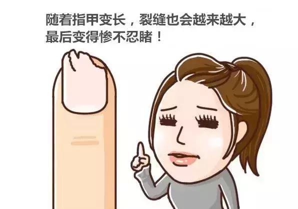 为什么剪指甲指甲会乱飞,剪指甲的时候指甲飞到鼻孔里