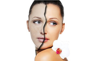 皮肤长斑怎么调理除去斑点,皮肤长斑的原因和调理方法