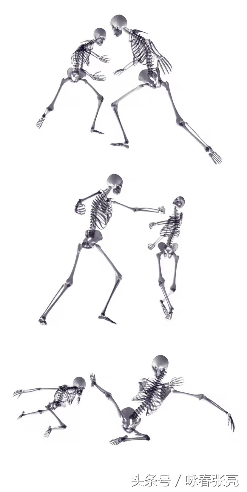 咏春拳十大杀招图解,咏春拳击打颈部招数